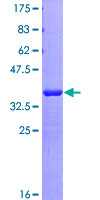 ab161736 on a 12.5% SDS-PAGE stained with Coomassie Blue.