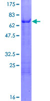 ab165817 on a 12.5% SDS-PAGE stained with Coomassie Blue.