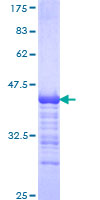 ab165818 on a 12.5% SDS-PAGE stained with Coomassie Blue.