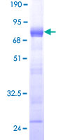 ab159585 on a 12.5% SDS-PAGE stained with Coomassie Blue.