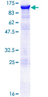 ab162914 on a 12.5% SDS-PAGE stained with Coomassie Blue.