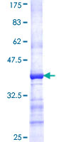 ab162915 on a 12.5% SDS-PAGE stained with Coomassie Blue.