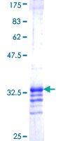 ab160761 on a 12.5% SDS-PAGE stained with Coomassie Blue.