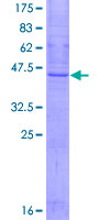 ab159942 on a 12.5% SDS-PAGE stained with Coomassie Blue.