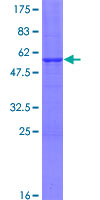 ab160884 on a 12.5% SDS-PAGE stained with Coomassie Blue.