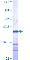 ab160885 on a 12.5% SDS-PAGE stained with Coomassie Blue.
