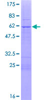 ab159590 on a 12.5% SDS-PAGE stained with Coomassie Blue.