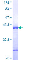 ab153012 on a 12.5% SDS-PAGE stained with Coomassie Blue.