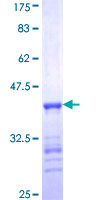 ab159510 on a 12.5% SDS-PAGE stained with Coomassie Blue.