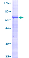 ab160231 on a 12.5% SDS-PAGE stained with Coomassie Blue.