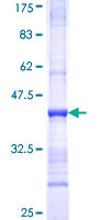 ab160232 on a 12.5% SDS-PAGE stained with Coomassie Blue.