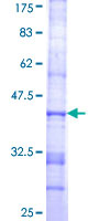 ab160973 on a 12.5% SDS-PAGE stained with Coomassie Blue.
