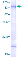 ab162523 on a 12.5% SDS-PAGE stained with Coomassie Blue.