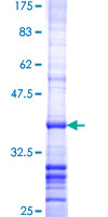 ab159591 on a 12.5% SDS-PAGE stained with Coomassie Blue.