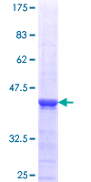 ab164620 on a 12.5% SDS-PAGE stained with Coomassie Blue.