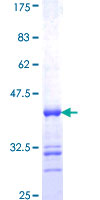 ab163235 on a 12.5% SDS-PAGE stained with Coomassie Blue.