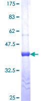 ab161070 on a 12.5% SDS-PAGE stained with Coomassie Blue.