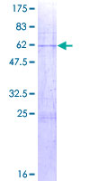 ab162075 on a 12.5% SDS-PAGE stained with Coomassie Blue.
