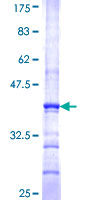 ab162076 on a 12.5% SDS-PAGE stained with Coomassie Blue.
