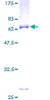 ab162318 on a 12.5% SDS-PAGE stained with Coomassie Blue.