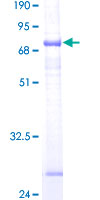 ab162319 on a 12.5% SDS-PAGE stained with Coomassie Blue.