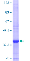 ab162320 on a 12.5% SDS-PAGE stained with Coomassie Blue.