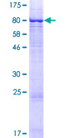 ab159920 on a 12.5% SDS-PAGE stained with Coomassie Blue.