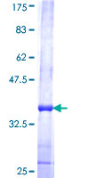 ab163129 on a 12.5% SDS-PAGE stained with Coomassie Blue.