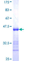 ab160904 on a 12.5% SDS-PAGE stained with Coomassie Blue.