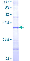 ab163151 on a 12.5% SDS-PAGE stained with Coomassie Blue.