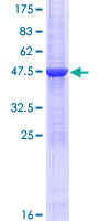 ab165381 on a 12.5% SDS-PAGE stained with Coomassie Blue.
