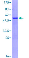 ab164289 on a 12.5% SDS-PAGE stained with Coomassie Blue.