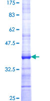 ab164290 on a 12.5% SDS-PAGE stained with Coomassie Blue.