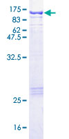 ab159594 on a 12.5% SDS-PAGE stained with Coomassie Blue.