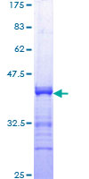 ab159595 on a 12.5% SDS-PAGE stained with Coomassie Blue.