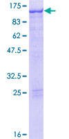 ab159597 on a 12.5% SDS-PAGE stained with Coomassie Blue.