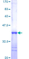 ab159598 on a 12.5% SDS-PAGE stained with Coomassie Blue.