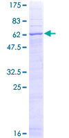 ab162041 on a 12.5% SDS-PAGE stained with Coomassie Blue.