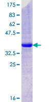 ab166098 on a 12.5% SDS-PAGE stained with Coomassie Blue.