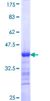 ab163355 on a 12.5% SDS-PAGE stained with Coomassie Blue.