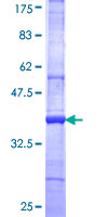 ab165895 on a 12.5% SDS-PAGE stained with Coomassie Blue.