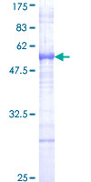 ab162096 on a 12.5% SDS-PAGE stained with Coomassie Blue.