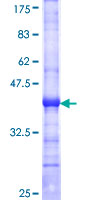ab153177 on a 12.5% SDS-PAGE stained with Coomassie Blue.