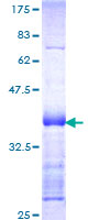 ab153297 on a 12.5% SDS-PAGE stained with Coomassie Blue.