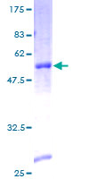 ab164334 on a 12.5% SDS-PAGE stained with Coomassie Blue.