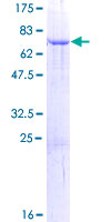 ab160470 on a 12.5% SDS-PAGE stained with Coomassie Blue.