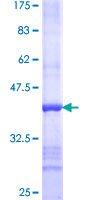 ab160471 on a 12.5% SDS-PAGE stained with Coomassie Blue.