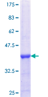 ab153561 on a 12.5% SDS-PAGE stained with Coomassie Blue.
