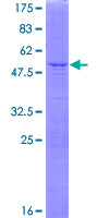 ab165889 on a 12.5% SDS-PAGE stained with Coomassie Blue.