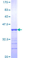 ab163082 on a 12.5% SDS-PAGE stained with Coomassie Blue.